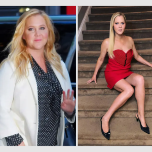 Amy Schumer Weight Loss: 5 Facts You Need to Know 
