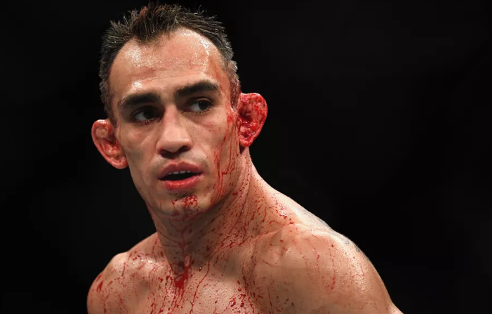 Tony Ferguson